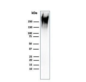 Western blot testing of human MCF7 cell lysate with recombinant MUC-1 antibody (clone rMUC1/960). Th