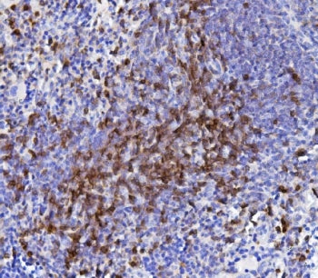 IHC staining of FFPE rat spleen with Cd5 antibody. HIER: boil tissue sections in pH8 EDTA for 20 min and allow to cool before testing.