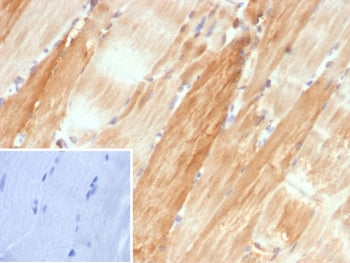 IHC staining of FFPE human skeletal muscle tissue with Crystallin Alpha B antibody (clone CRYAB/4662