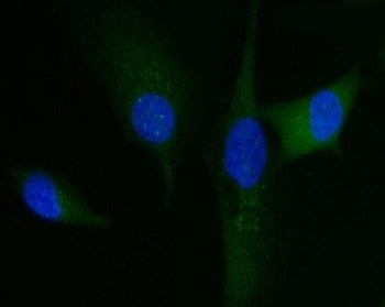 Immunofluorescent staining of FFPE human U-87 MG cells with HGF-regulated tyrosine kinase substrate 