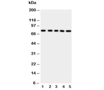 Western blot testing of ABCG2 antibody and Lane 1: HeLa; 2: SW620; 3: MCF-7; 4: SKOV; 5: Jurkat cell