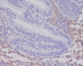 IHC staining of FFPE human uterus tissue with PDGFRB antibody. HIER: boil tissue sections in pH6, 10