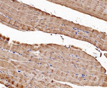 IHC staining of FFPE human skeletal muscle with CACNA1S antibody. HIER: boil tissue sections in pH8 