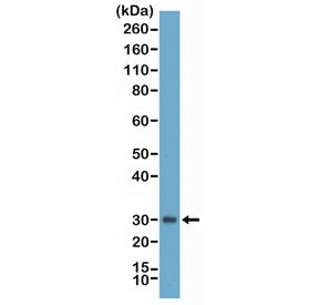 Western blot testing of human plasma with recombinant Asprosin antibody at 1:25000. Predicted molecu