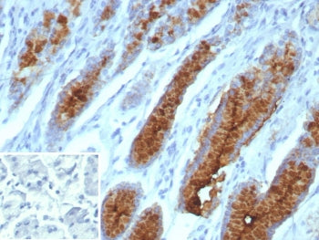 IHC staining of FFPE human stomach tissue with recombinant Mucin 5AC antibody (clone MUC5AC/7066R). HIER: boil tissue sections in pH 9 10mM Tris with 1mM EDTA for 20 min and allow to cool before testing.
