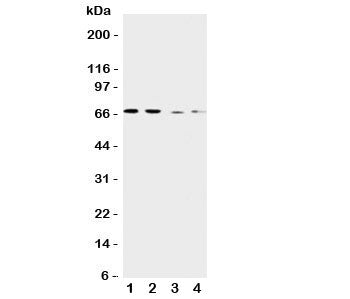 Western blot testing of CAT1 antibody and Lane 1: human placenta; 2: HeLa; 3: SKOV-3; 4: HT1080 cell