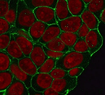 Immunofluorescent staining of human HeLa cells with recombinant Beta Catenin antibody (clone CTNB1-1