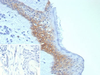 IHC staining of FFPE human skin tissue with Desmoglein-3 antibody (clone DSG3/8252R). Inset: PBS use