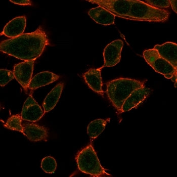 Immunofluorescent staining of PFA-fixed human HeLa cells using ZBTB39 antibody (green, clone PCRP-ZB
