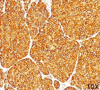 Tyrosinase Antibody