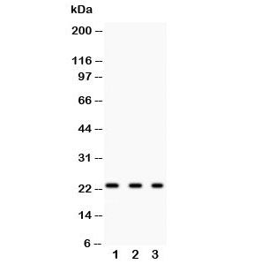 GST pi Antibody