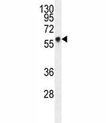 Glypican 3 Antibody (GPC3)