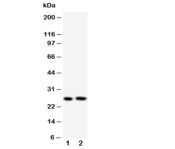 Western blot testing of Surfactant protein A antibody and Lane 1: mouse lung; 2: rat lung tissue lys