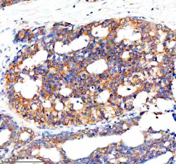 Immunohistochemical staining of NCR3LG1 using anti-NCR3LG1 antibody. NCR3LG1 was detected in a paraf