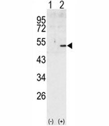 Western blot analysis of Cyclin A2 antibody and 293 cell lysate (2 ug/lane) either nontransfected (L