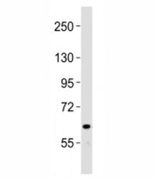 Western blot testing of NOTCH4 antibody at 1:2000 dilution + human liver lysate; Predicted band size