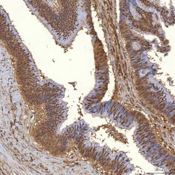 PIG3 Antibody / TP53I3