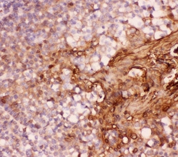 Annexin A1 Antibody