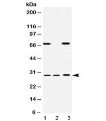 PSMA4 Antibody / Proteasome 20S alpha 4