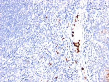Myeloid Marker / MYADM Antibody