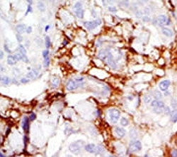 PAK3 Antibody