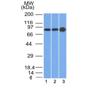 Plakophilin 1 Antibody