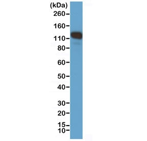 Western blot testing of human A375 cell lysate with recombinant CD146 antibody at 1:1000. Observed m