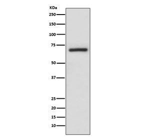 Western blot testing of human A375 cell lysate with A-Raf antibody. Predicted molecular weight ~67 k