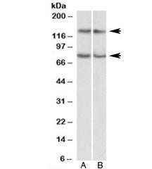 Western blot testing of Jurkat [A] and HeLa [B] lysates with CAPRIN1 antibody at 0.3ug/ml. Predicted