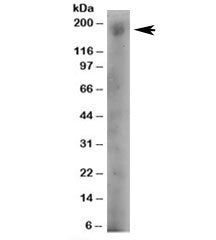 Western blot testing of human A431 lysate with DOCK1 antibody at 4ug/ml. Predicted molecular weight: