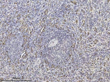 IHC staining of FFPE human spleen tissue with SLC4A1 antibody. HIER: boil tissue sections in pH8 EDT