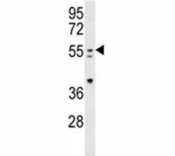 PAX-7 antibody western blot analysis in mouse spleen tissue lysate. Expected molecular weight: 55-57