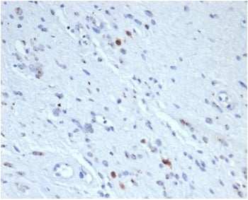 Recombinant MYOG Antibody / Myogenin / Myf-4