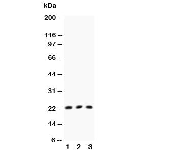 Western blot testing of TNFb antibody and Lane 1: HeLa; 2: MCF-7; 3: COLO320