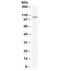 Western blot testing of rat lung lysate with CD26 antibody at 0.3ug/ml. Predicted molecular weight: 