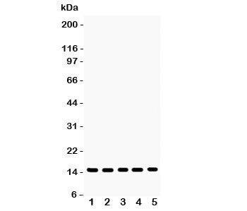 Western blot testing of Profilin-1 antibody and Lane 1: rat testis; 2: mouse testis; 3: human placen