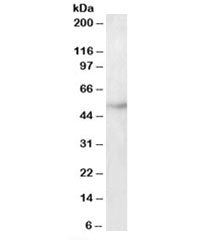 Western blot testing of HepG2 lysate with TUBB3 antibody at 2ug/ml. Predicted molecular weight: ~50k