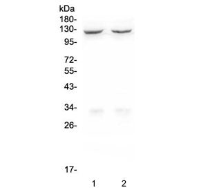 Western blot testing of human 1) HEK293 and 2) HepG2 cell lysate with CD41 antibody. Expected molecu