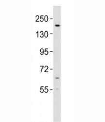 KDM6B Antibody