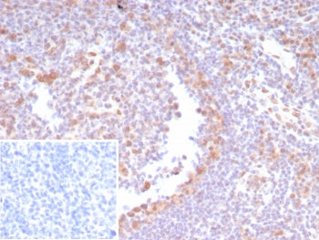 IHC staining of FFPE human tonsil tissue with CDK4 antibody (clone CDK4/8210R). Inset: PBS used in p