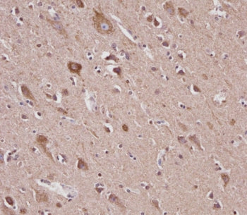 IHC testing of FFPE human brain tissue with VDAC2 antibody. HIER: steam section in pH6 citrate buffe