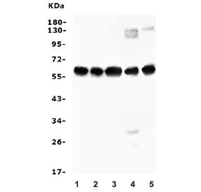Western blot testing of human 1) A549, 2) A431, 3) HEK293, 4) ThP-1 and 5) Caco-2 cell lysate with A