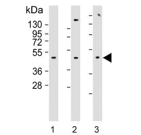 Western blot testing of human 1) MCF7, 2) MDA-MB-231 and 3) SK-BR-3 cell lysate with Alpha-2B Adrene