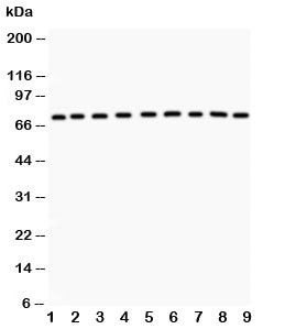 Western blot testing of GHR antibody and Lane 1: rat liver; 2: (r) kidney; 3: (r) spleen; 4: (r) int