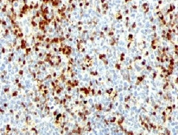 IHC testing of FFPE human tonsil with ZAP-70 antibody (clone ZTP70-1).