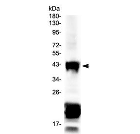 Western blot testing of mouse eye ball lysate with CHX10 antibody at 0.5ug/ml. Predicted molecular w