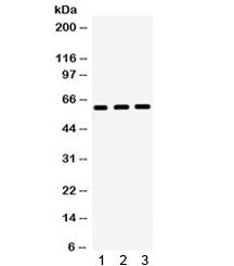 HNF1B Antibody