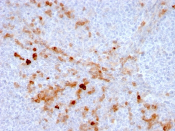 IHC staining of FFPE human tonsil with CD105 antibody (clone ENG/3269). HIER: boil tissue sections i