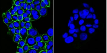EGF Receptor / EGFR Antibody