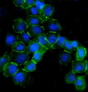 Immunofluorescent staining of FFPE human A431 cells with beta Catenin antibody (green) and DAPI nucl